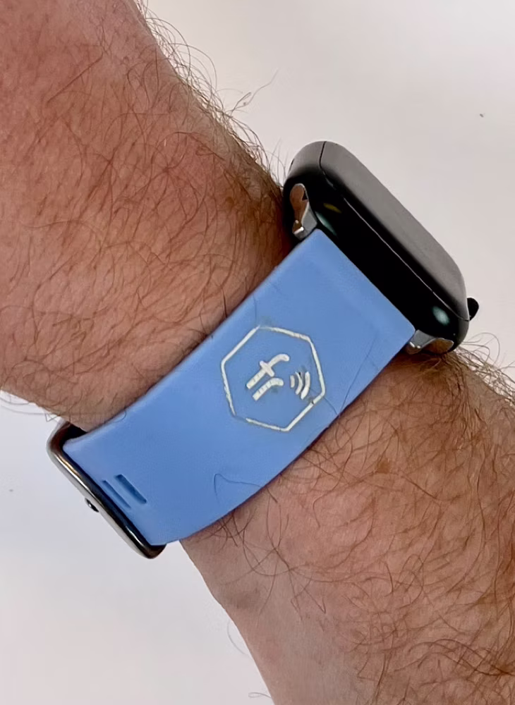 The blue prototype band worn on a wrist with a black Apple Watch